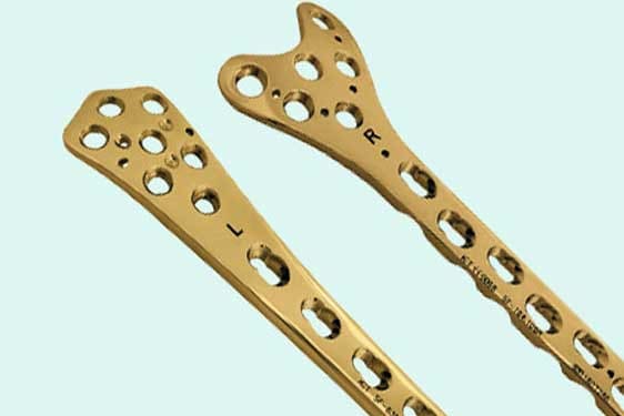 a titanium orthopedic implant