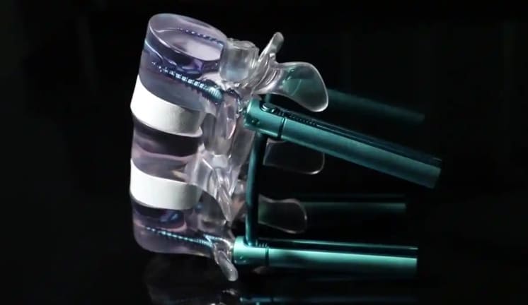 Future Advancements in Medical Implant Manufacturing