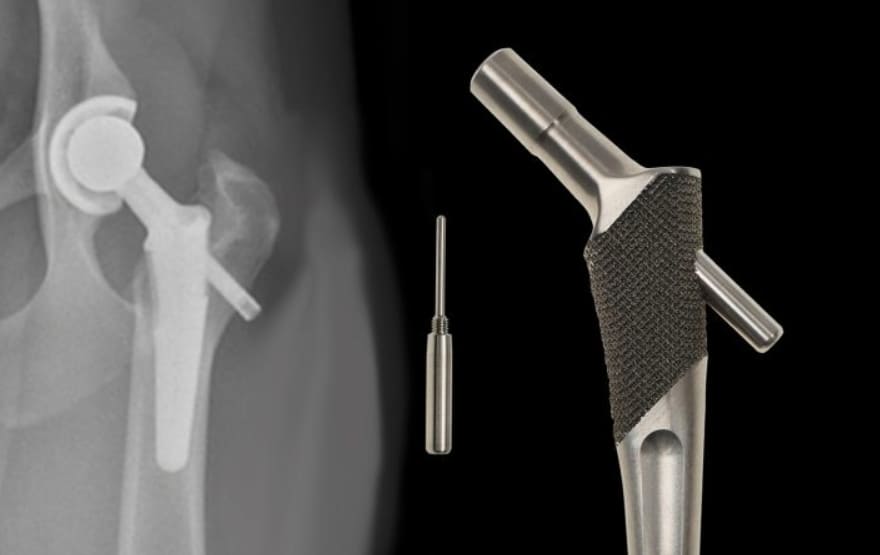Important Factors in Implant Manufacturing